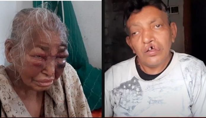  பெற்ற தாயை தாக்கிவிட்டு எதிர்க்கட்சியினர் மீது பழி போட்ட பா.ஜ.க நிர்வாகி : அம்பலமான அரசியல் நாடகம்!