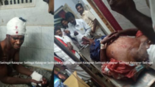 தோல்வி பயத்தில் திமுக வேட்பாளரை கொலை செய்ய முயற்சி: தடுக்க முயன்ற 4 பேர் படுகாயம் - அதிமுகவினர் அராஜகம்!