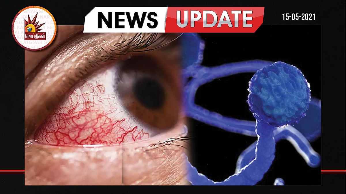 கொரோனா பாதித்தவர்களை தாக்கும் ‘கருப்பு பூஞ்சை’ தொற்று.. மகாராஷ்டிராவில் 1000 பேர் பாதிப்பு.. 52 பேர் பலி!