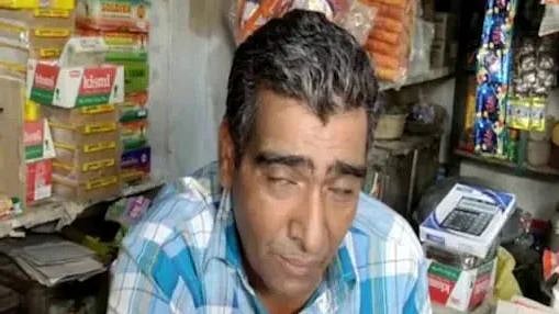 'நிஜத்தில் ஒரு கும்பகர்ணன்'... வருடத்தில் 300 நாள் தூக்கம் - விநோத நோயால் அவதிப்படும் ராஜஸ்தான் மனிதர்!