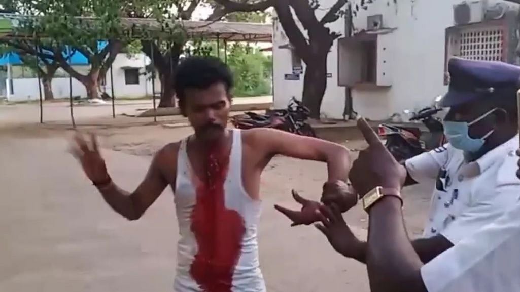 கண்ணாடியை உடைத்து கழுத்தை அறுத்துக் கொண்ட மனநலம் பாதிக்கப்பட்டவர் - உயிரை காப்பாற்றிய இளைஞர்கள் !