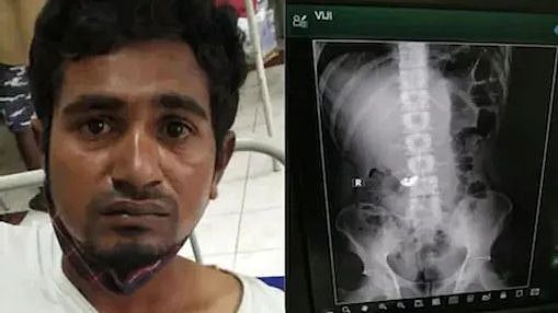 பலே திருடன்... கொள்ளையை காட்டிக் கொடுத்த X-ray: அதிர்ச்சியடைந்த பெங்களூரு போலிஸ்!