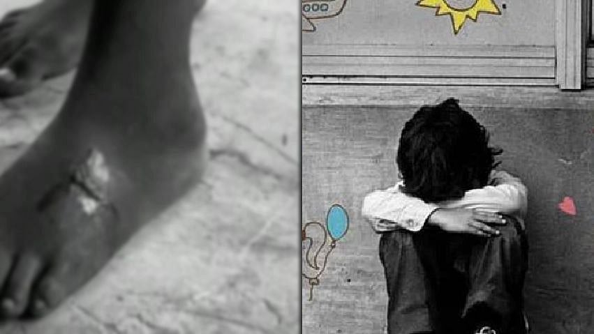 சாலையில் வலியோடு நடந்துச் சென்ற சிறுவன்.. பெற்ற மகனுக்குச் சூடுவைத்த கொடூரத் தாய் : அதிர்ச்சி தகவல்!