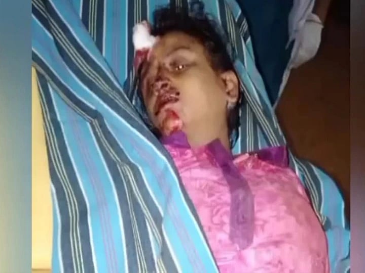 கருத்துவேறுபாடு.. காப்பகத்தில் தங்கிய மனைவி - ஆத்திரத்தில் சரமாரியாக வெட்டிய கணவன்: தேனியில் பயங்கரம்!