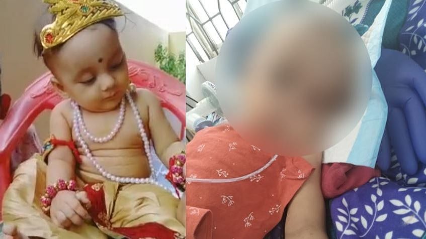 ரத்த உறைதலால் உயிருக்கு போராடும் 8 மாத பெண் குழந்தை; சிகிச்சை செலவை ஏற்ற தமிழ்நாடு அரசு!