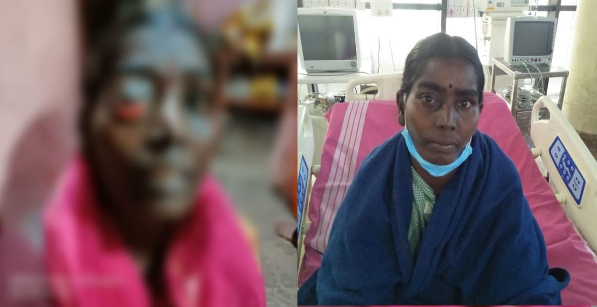 “அசந்திருந்தா உயிரே போயிருக்கும்” : சிறப்பான சிகிச்சையளித்து ஏழை பெண்ணை காப்பாற்றிய அரசு மருத்துவர்கள்!