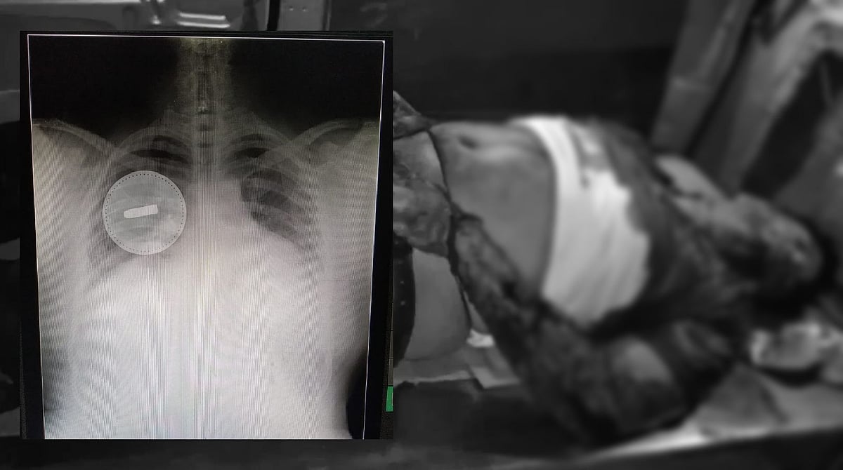 “டாஸ்மாக் ஊழியர் உடலில் இருந்த துப்பாக்கி குண்டு.. துப்பாக்கி முனையில் நடந்த கொள்ளை?” : ‘பகீர்’ தகவல்! 