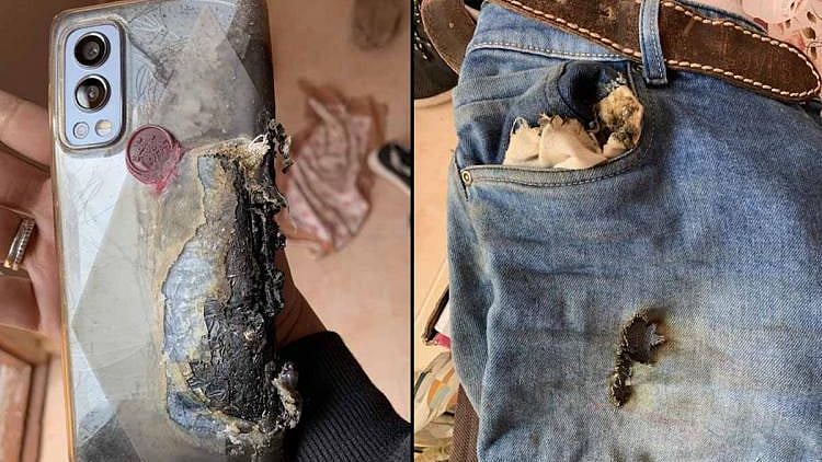 பேண்ட் பாக்கெட்டில் இருந்தபோது வெடித்த ‘ONEPLUS’ PHONE.. இளைஞருக்கு நேர்ந்த கொடூரம் - நடந்தது என்ன?