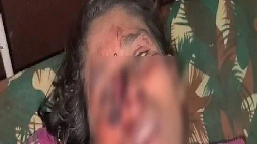 ”தண்ணி அடிக்க காசு தராததால் ஆத்திரம்; காதலியின் மூக்கை கோடாரியால் அறுத்த காதலன்” - ம.பியில் பகீர்!