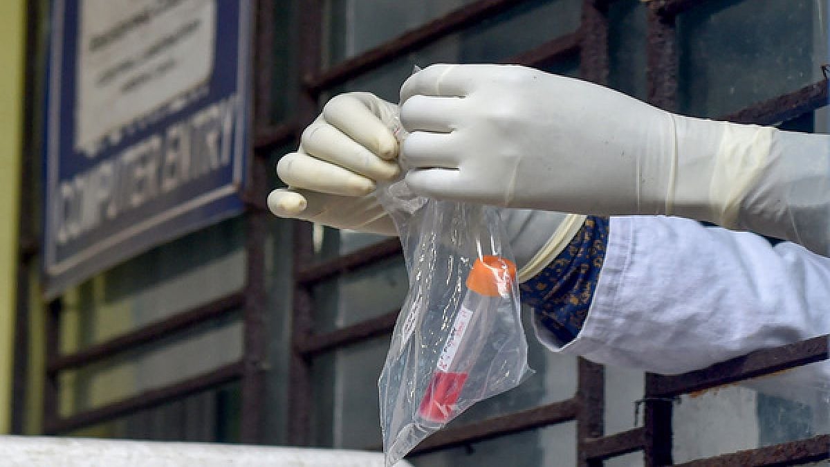 “இதுக்கு முடிவே இல்லையா?”: மிரட்டும் NeoCoV.. 3-ல் ஒருவர் மரணம் - ‘பகீர்’ எச்சரிக்கை விடுத்த சீனா, ரஷ்யா!