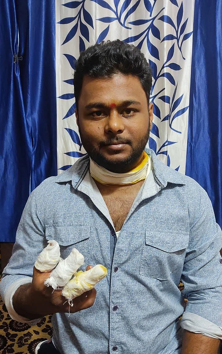”3 விரல்கள், கழுத்தில் படுகோயம்” - மாஞ்சா நூலால் இளைஞருக்கு நேர்ந்த சோகம்; மும்பையில் பரிதாபம்!