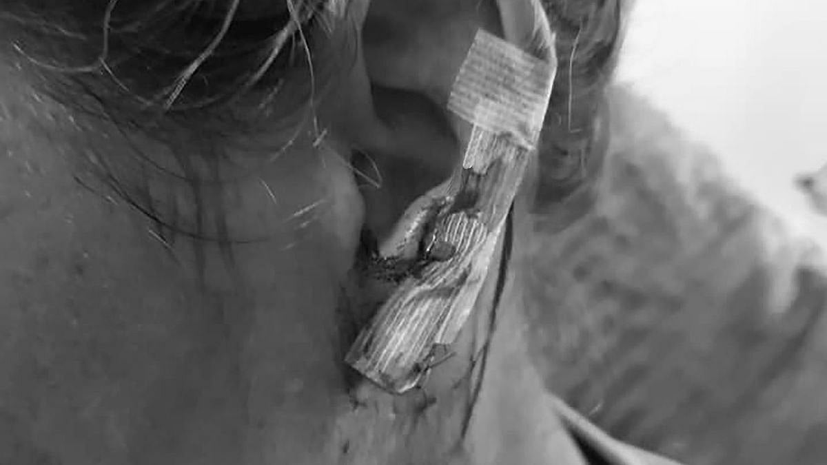 500 ரூபாய் கடனை திருப்பிக் கேட்டதற்காக காதை கடித்த நபர்... புதுக்கோட்டையில் அதிர்ச்சி!