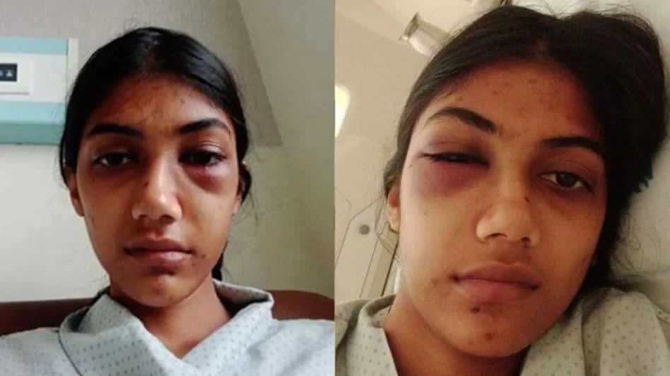 காதலுக்கு தடையாக இருந்த மருமகளின் முகத்தை சிதைத்த மாமியாரின் காதலன்: கேரளாவில் நடந்த பயங்கரம்!