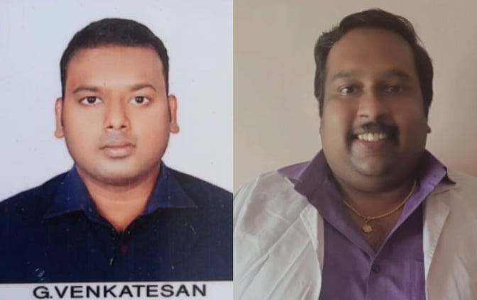 பல் துலக்கும்போது பெண்ணின் வாயில் சிக்கிய டூத் பிரஷ்; காஞ்சியில் வெற்றிகரமாக அகற்றிய அரசு மருத்துவர்கள்!