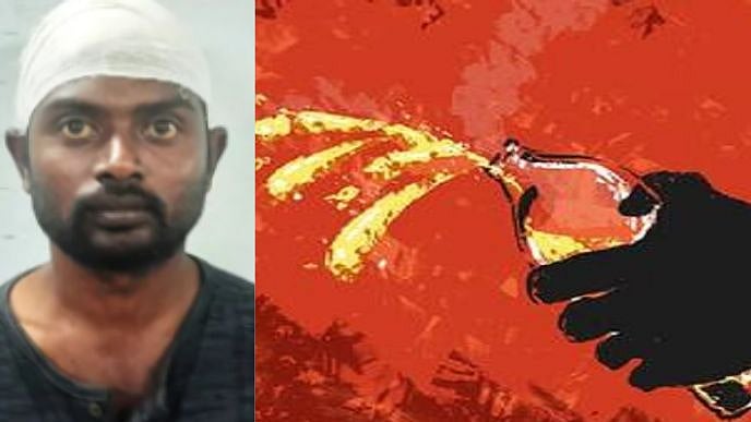 TV சத்தமாக வைத்து பார்த்த முதியவர் மீது ஆசிட் வீச்சு.. இளைஞரின் கொடூர செயல் - உறவினர்கள் அதிர்ச்சி!