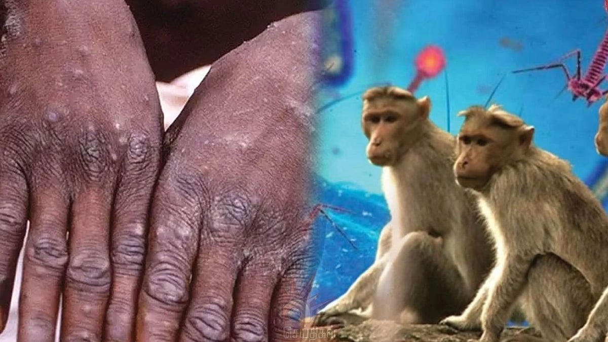 கொரோனாவை அடுத்து.. 11  நாடுகளுக்கு பரவிய குரங்கு வைரஸ்: அதிர்ச்சியில் உலக நாடுகள்!