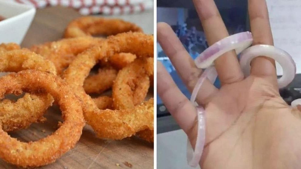 ஆர்டர் செய்ததோ ஆனியன் ரிங்ஸ்.. வந்ததோ.. அதிர்ச்சியடைந்த வாடிக்கையாளர் செய்தது என்ன தெரியுமா?