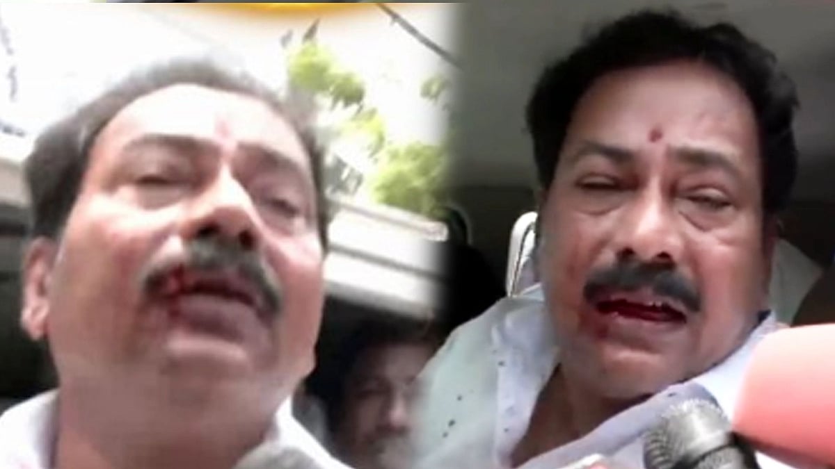 ”நீ எடப்பாடி ஆளான்னு கேட்டு வாயில குத்திட்டாங்க” : ரத்தம் வழிய பேசிய அ.தி.மு.க நிர்வாகி!