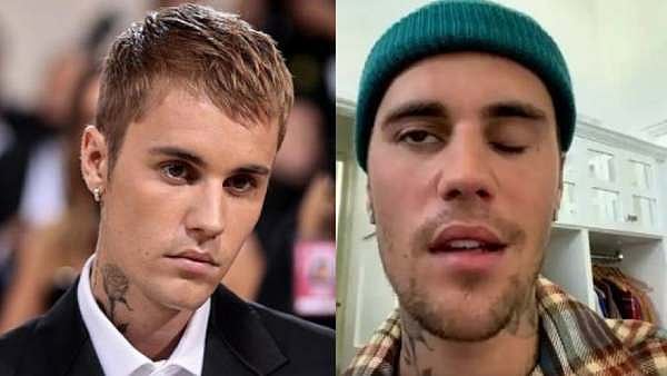 அரிய வகை பக்கவாத நோய்..  முகத்தின் ஒருபகுதி முடக்கம் - ஜஸ்டின் பெய்பர் வெளியிட்ட வீடியோ!