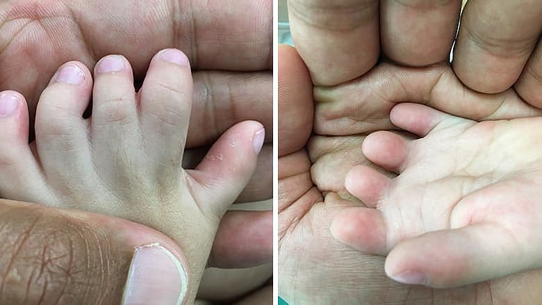 “துண்டிக்கப்பட்ட சிசுவின் தலை.. தாயின் வயிற்றில் வைத்து தைக்கப்பட்ட கொடூரம்” - பின்னணி என்ன?