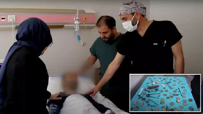 வயிற்றில் 233 பொருட்கள்.. மினி குப்பை தொட்டியையே வைத்திருந்த நபரால் மருத்துவர்கள் அதிர்ச்சி!