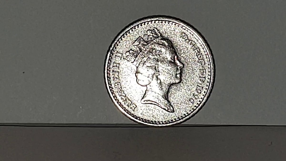 14 வயது சிறுவன் மூக்கில் சிக்கிய 5 நாணயங்கள்.. பெற்றோரிடம் சிறுவன் கூறிய அதிர்ச்சி காரணம் என்ன தெரியுமா?