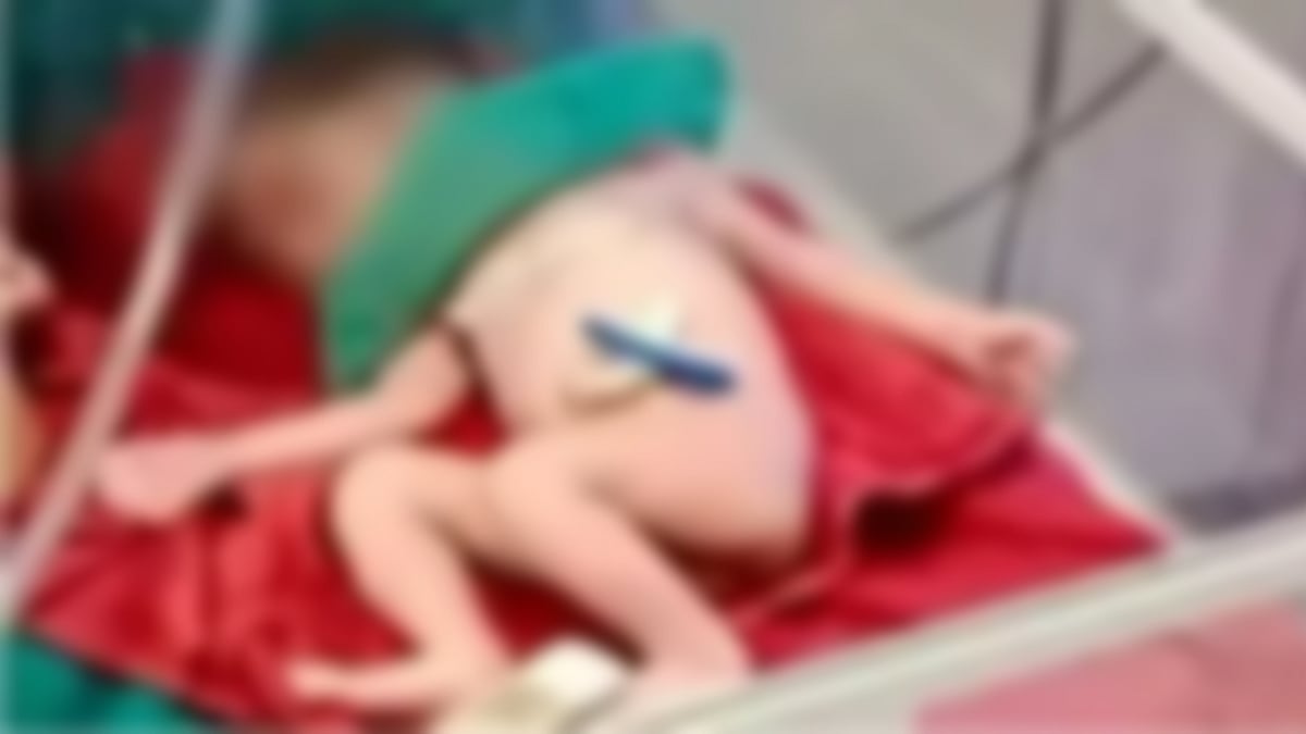 சாலை விபத்தில் சிக்கிய கர்ப்பிணி பெண்.. இறுதி தருணத்தில் பிறந்த குழந்தை: 'இறந்தாலும் வாழவைக்கும் தாய் !'