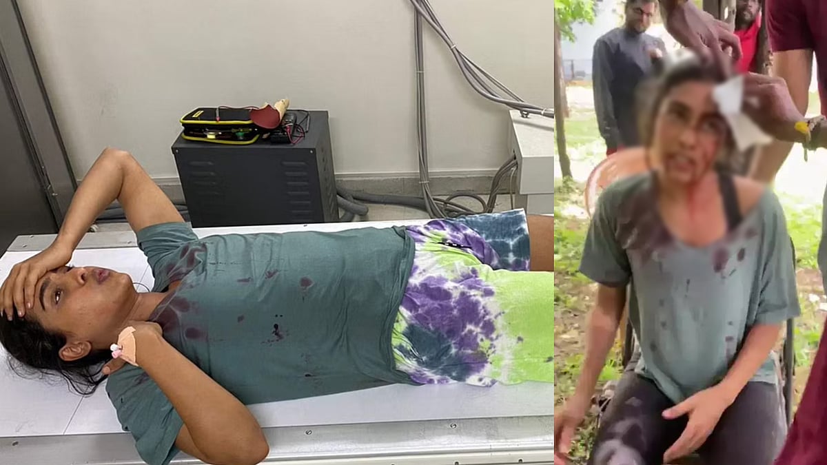 படப்பிடிப்பின் போது ஏற்பட்ட விபத்து.. இரத்தம் வழிய மருத்துவமனைக்கு கொண்டு போன 'கோமாளி' பட நடிகை.. 