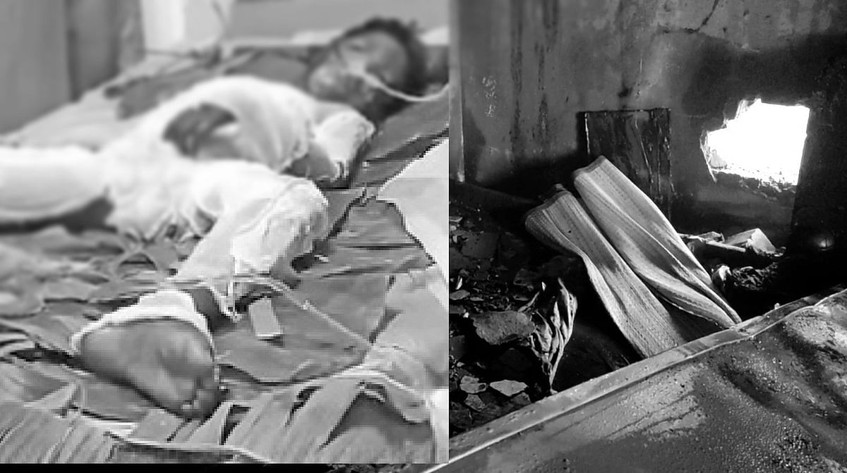 காதல் மனைவியுடன் ஏற்பட்ட சண்டை.. பெற்ற மகனின் மீது பெட்ரோல் ஊற்றி எரித்த தந்தை - பகீர் சம்பவம் !