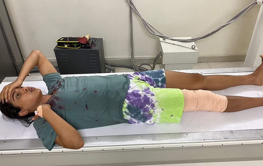 படப்பிடிப்பின் போது ஏற்பட்ட விபத்து.. இரத்தம் வழிய மருத்துவமனைக்கு கொண்டு போன 'கோமாளி' பட நடிகை..