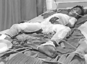 காதல் மனைவியுடன் ஏற்பட்ட சண்டை.. பெற்ற மகனின் மீது பெட்ரோல் ஊற்றி எரித்த தந்தை - பகீர் சம்பவம் !