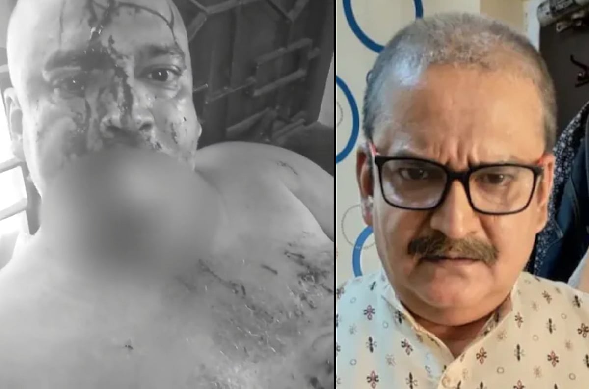 பிரபல நடிகர் தற்கொலை முயற்சி... ‘மனைவி, மாமியார் கொடுமை தாங்கமுடியல’ - போலிஸிடம் குமுறல் !