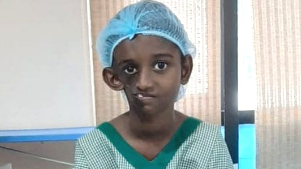 "operation முடிஞ்சிருச்சு.. சீக்கிரமா school போகலாம்" -அறுவை சிகிச்சை முடிந்த சிறுமியிடம் முதல்வர் !