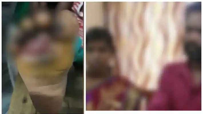 4 வயது குழந்தையின் காலை தீவைத்து எரித்த கொடூரம்.. தாய் மற்றும் அவரின் காதலர் அதிரடி கைது ! 