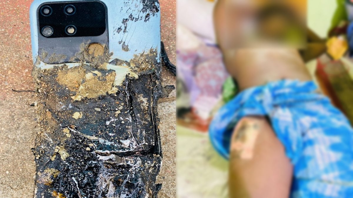 பைக்கில் செல்லும்போது திடீரென வெடித்த புதிய செல்போன்.. தீப்பிடித்து சிறுவனுக்கு நேர்ந்த சோகம் !