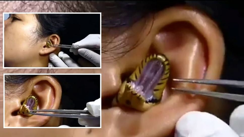 பெண்ணின் காதுக்குள் புகுந்த பாம்பு.. இணையத்தில் வைரலாகி வரும் பகீர் வீடியோ!