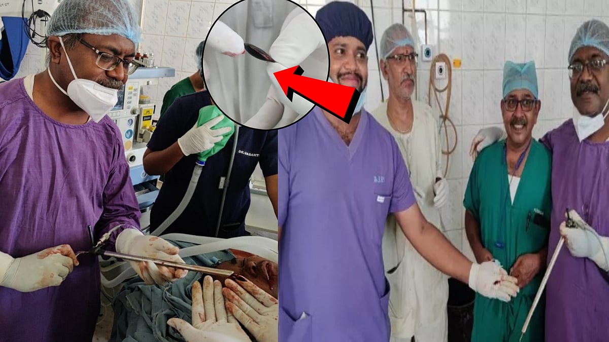 2 மாதங்களாக நுரையீரலில் சிக்கியிருந்த சப்போட்டா விதை.. அறுவை சிகிச்சை மூலம் அகற்றிய அரசு மருத்துவர்கள் !