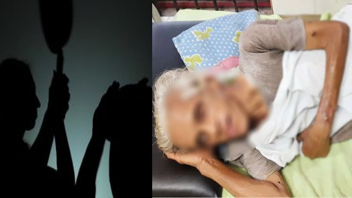 4 ஆண்டுகளாக துன்புறுத்தல்.. மாமியாரை கொடூரமாக தாக்கி பார்வையை பறித்த மருமகள்.. கேரளாவில் அதிர்ச்சி !