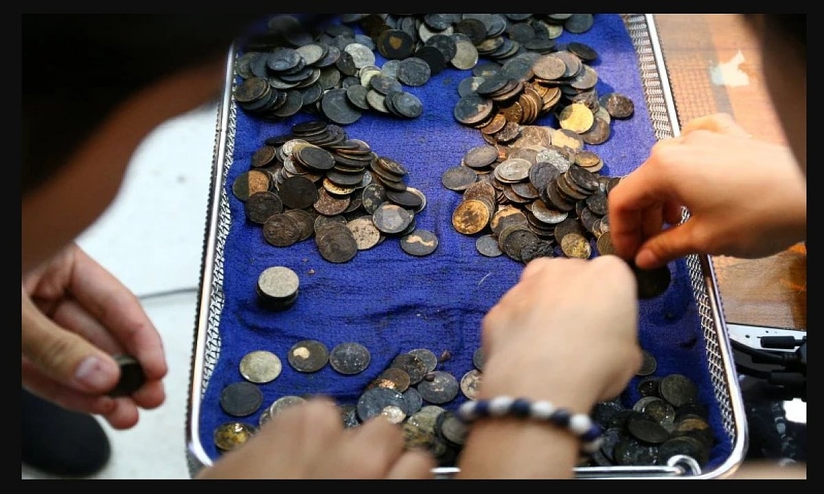 முதியவரின் வயிற்றில் 187 நாணயங்கள்.. ஒன்றரை கிலோ எடை இருந்ததால் மருத்துவர்கள் அதிர்ச்சி ! 