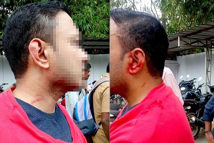 பெங்களூரு: முந்தி செல்வதில் போட்டி.. காதில் இருந்து இரத்தம் வழிய பைக் ஓட்டுநரை தாக்கிய பேருந்து ஓட்டுநர்!