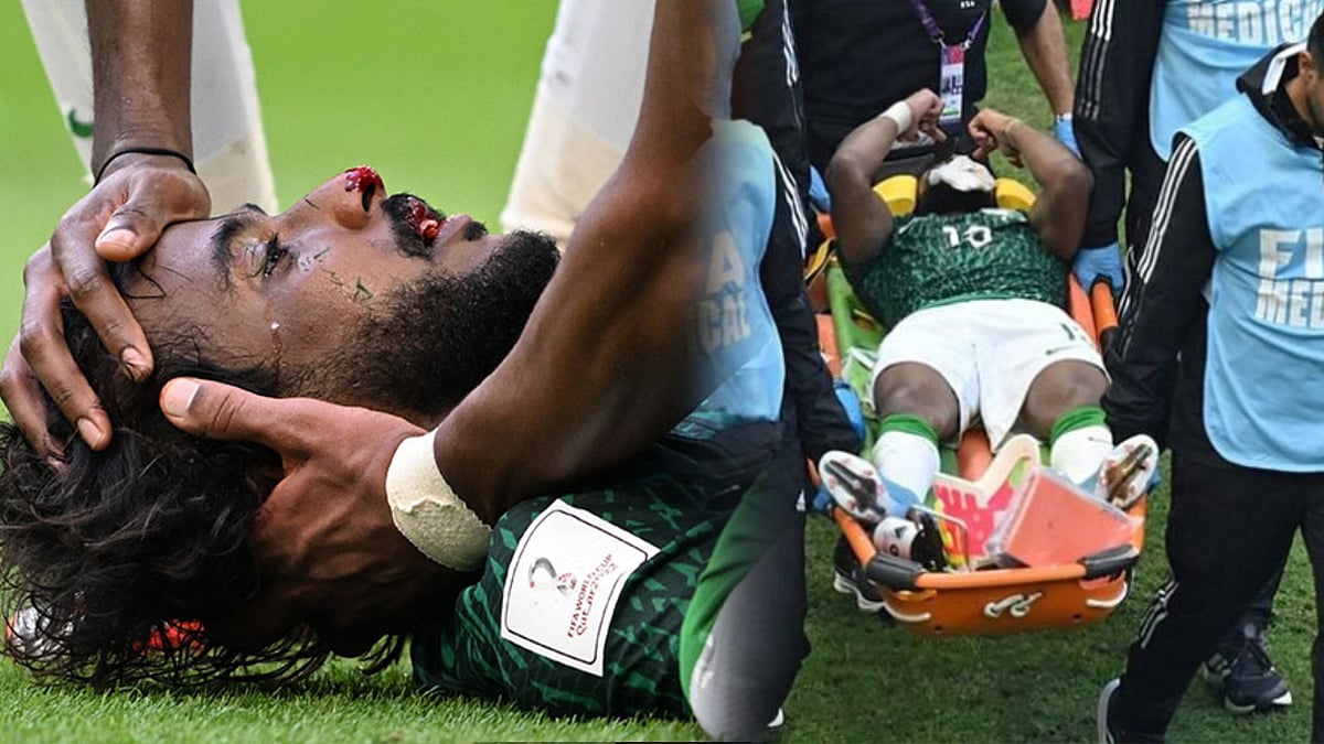 உடைந்த தாடை எலும்பு.. உலக கோப்பையில் படுகாயமடைந்த வீரர் தீவிர சிகிச்சை பிரிவில் அனுமதி.. நடந்தது என்ன ?