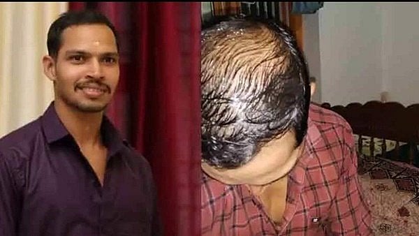 தலைமுடி கொட்டியாதல் விரக்தி.. உருக்கமாக கடிதம் எழுதி விபரீத முடிவெடுத்த இளைஞர்!