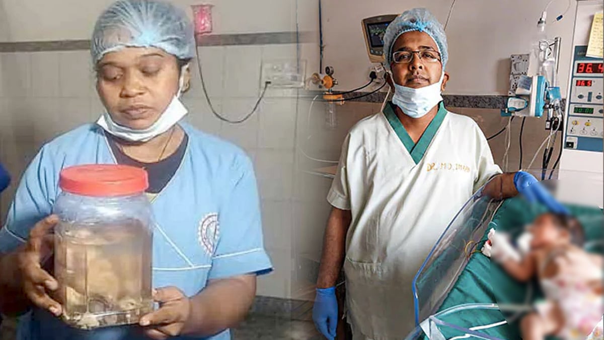 ஜார்க்கண்ட் : பிறந்த குழந்தையின் வயிற்றில் கட்டி என்று நினைத்த மருத்துவர்களுக்கு காத்திருந்த அதிர்ச்சி..