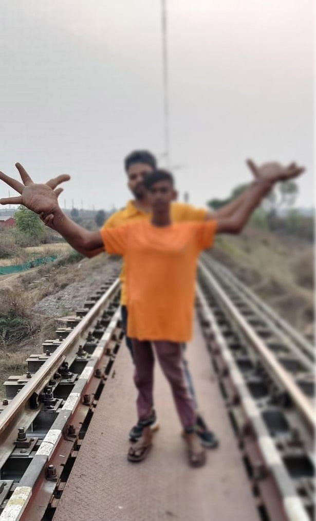 Hulk Hand.. 2 கையும் 8 கிலோ: அரியவகை நோயால் பாதித்த 16 வயது சிறுவனை ஒதுக்கிவைத்த கிராமம்!