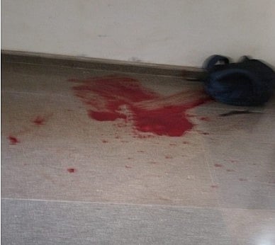 மாணவி குத்தி கொலை.. அதே இடத்தில் தற்கொலைக்கு முயன்ற வாலிபர்: கல்லூரி வளாகத்தில் நடந்த பகீர் சம்பவம்!