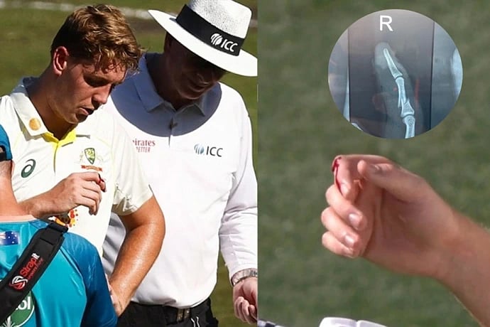 ரூ.17.5 கோடி செலவு செய்தது எல்லாம் இதற்குதானா? IPL தொடரில் மும்பை அணிக்கு ஆப்பு வைத்த ஆஸ்திரேலியா !