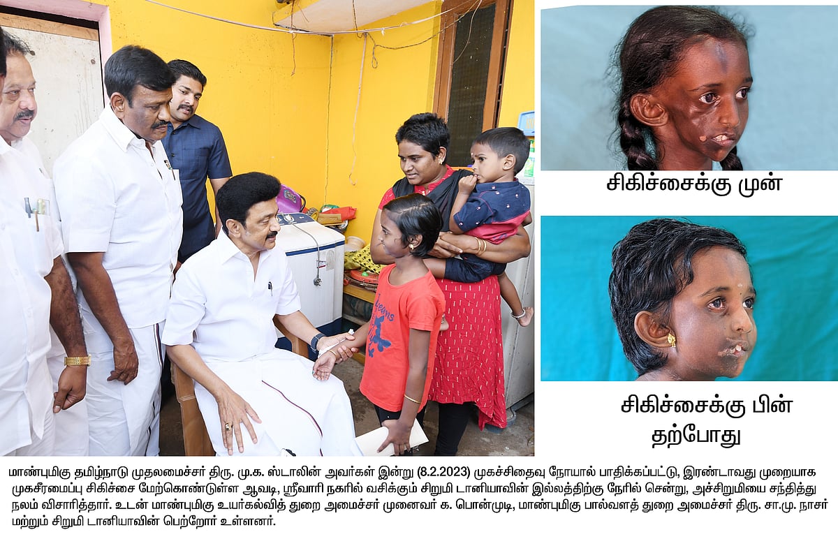 “கடவுளே கைவிட்ட போதும் என் குழந்தைக்கு மறுவாழ்வு அளித்த தெய்வம் முதல்வர்தான்” : டானியாவின் தாய் நெழ்ச்சி!