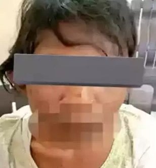 உடல் முழுவதும் காயம்.. சூடுவைத்து சித்ரவதை: வேலைக்கு அழைத்து வந்து சிறுமியைக் கொடுமைப் படுத்திய தம்பதி!