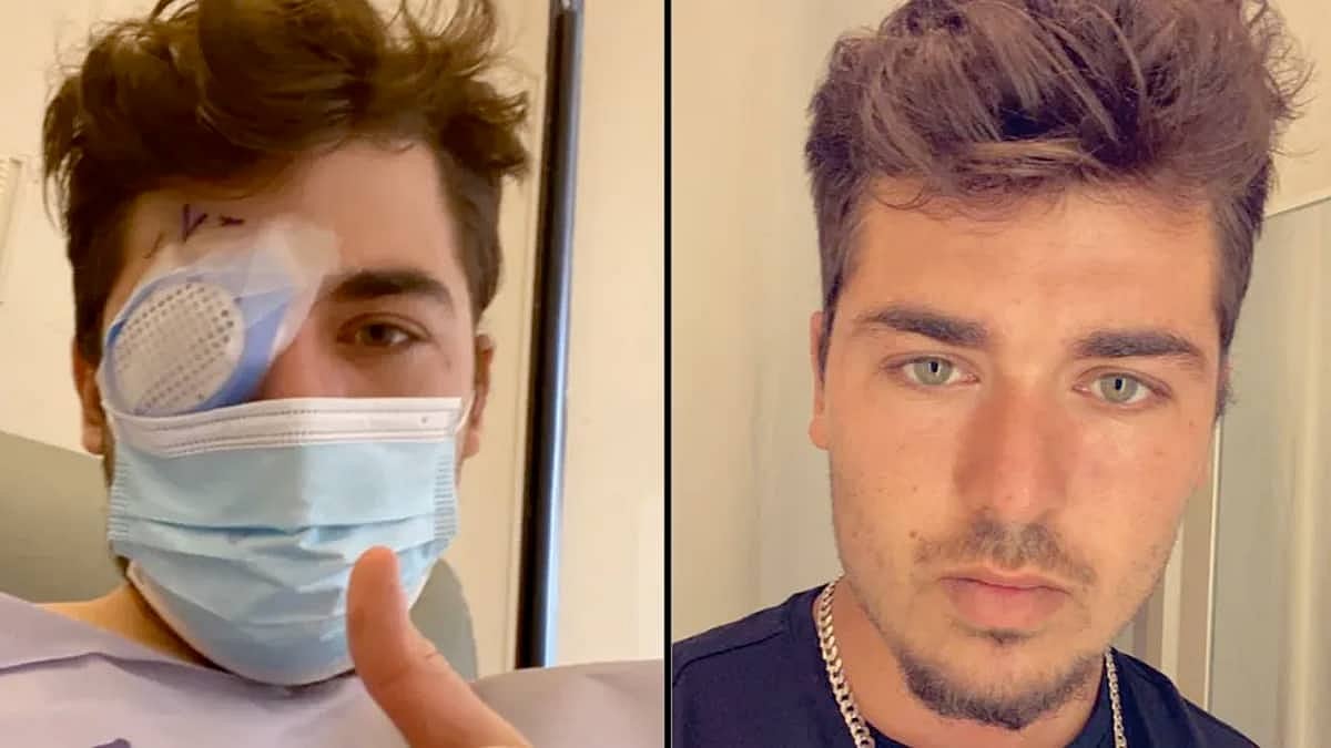 மக்களே உஷார்..! Lens போட்டு தூங்கிய நபர்.. திடீரென காணாமல் போன கருவிழி.. அதிர்ச்சியில் இளைஞர் !