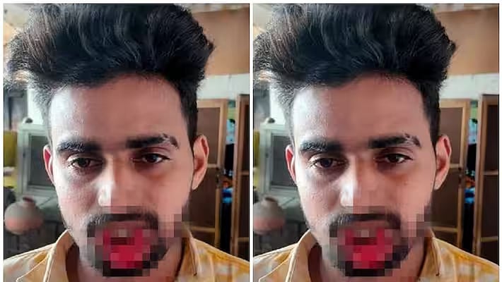 அத்துமீறிய இளைஞர்.. சுதாரித்து கொண்ட பெண்ணின் செயலால் துண்டான இளைஞரின் உதடு.. உ.பியில் நடந்தது என்ன ?